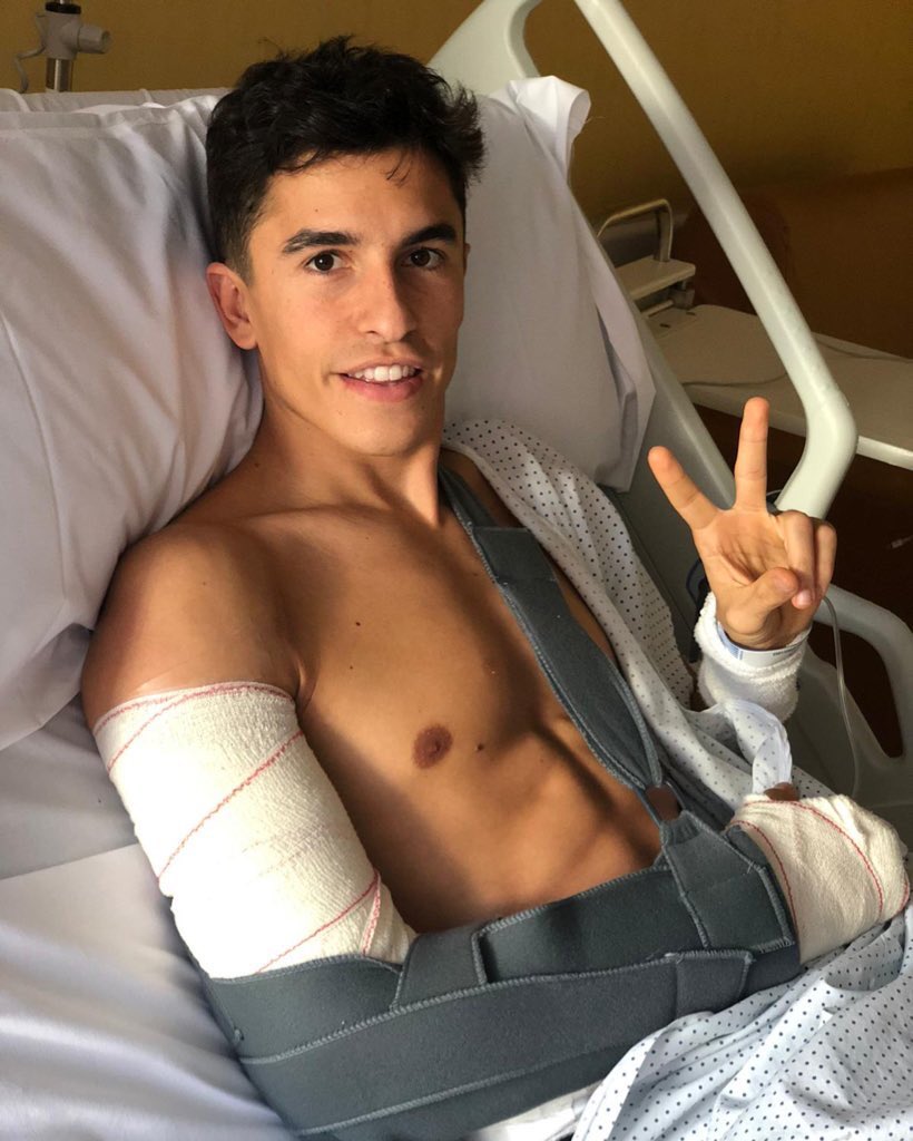 Марк Маркес после 3-й операции в госпитале Рубера