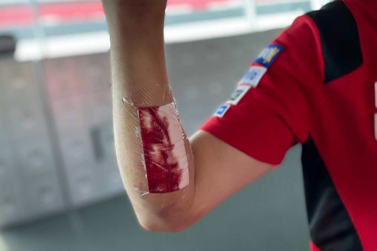 Джек Миллер порвал швы на правой руке при падении в Гран-При Португалии